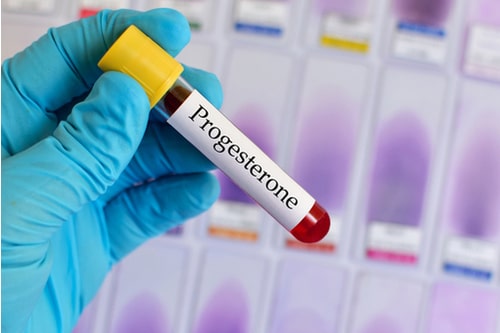 What Do I Need To Know About The Day 21 Progesterone Test